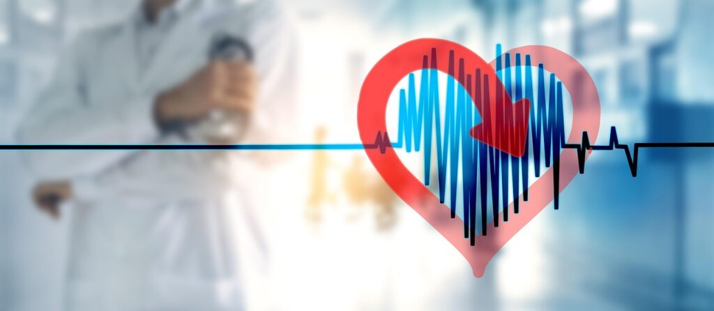 atrial fibrillation, cardiac arrhythmia, heart, irregular, heartbeat, heart racing, weakness, stroke, medicine, doctor, hospital, risk, discomfort, treatment, health, disease, stroke, doctor, doctor, doctor, hospital, hospital, hospital, hospital, hospital