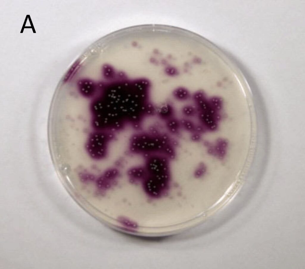 microorganisms in food
