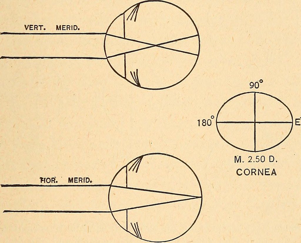 corneal power cylindrical power
