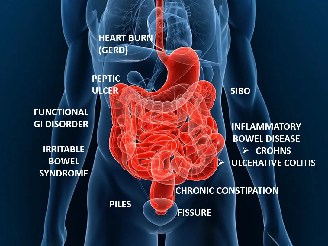 gut microbiota