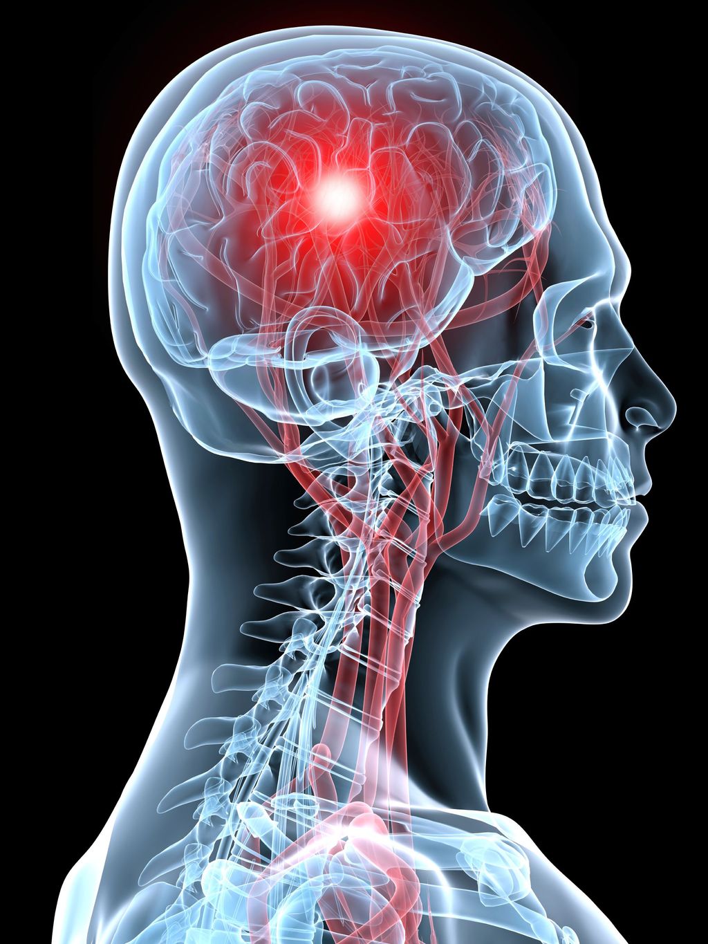 Decoding the Body’s Urgent Call: Your Comprehensive Guide to Identifying Stroke Warning Signs