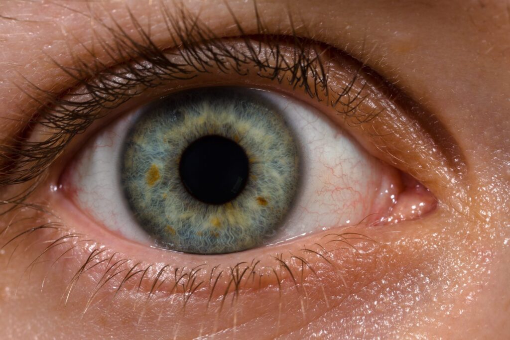 Eye and Vision Changes: The 'E' in BE FAST