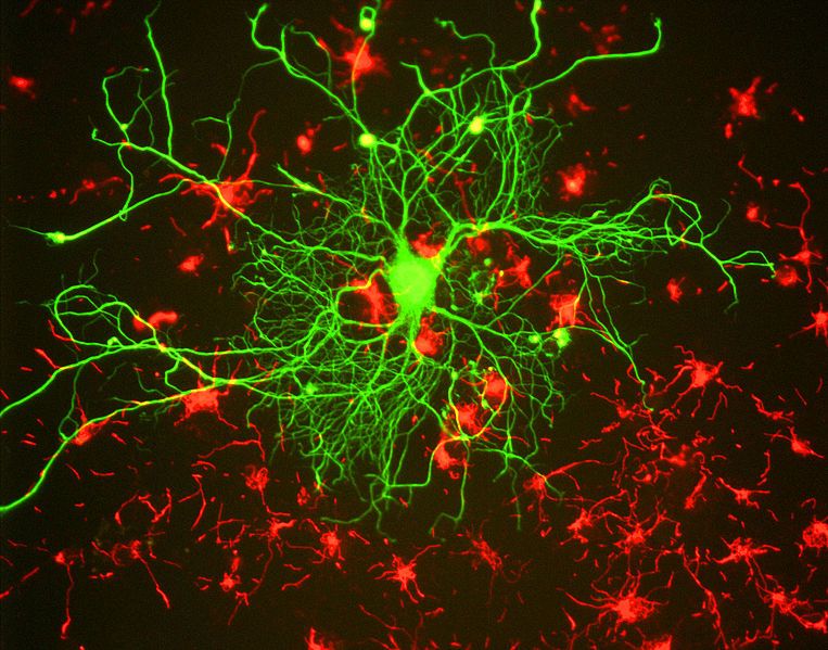 larger SuperAger neurons