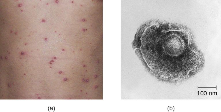 The Viral Outbreak: What the Initial Videos Showed.