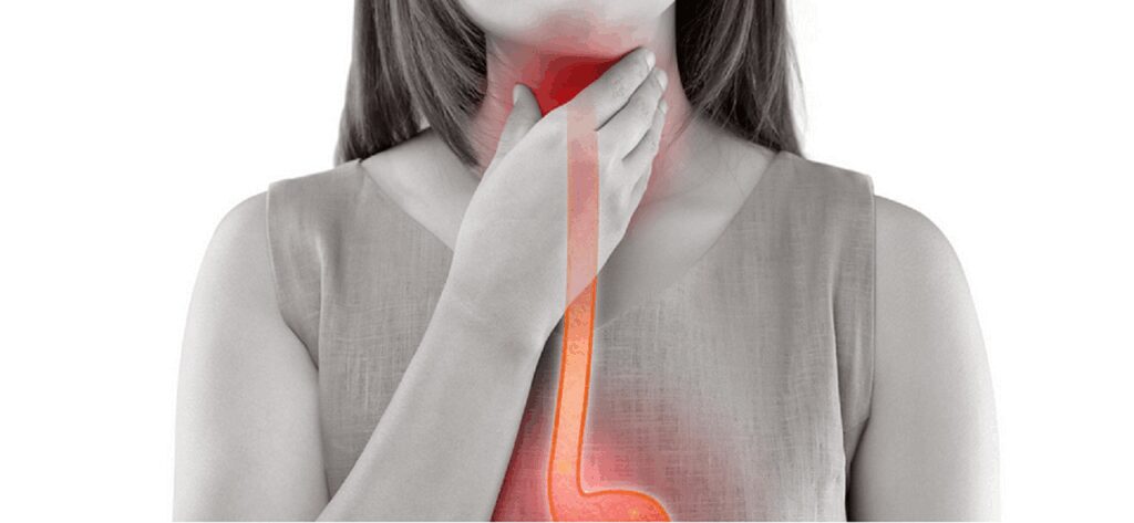 achalasia, achalasia causes, achalasia symptoms, achalasia diagnosis, sore throat, esophagus, sore throat, sore throat, sore throat, sore throat, sore throat, esophagus