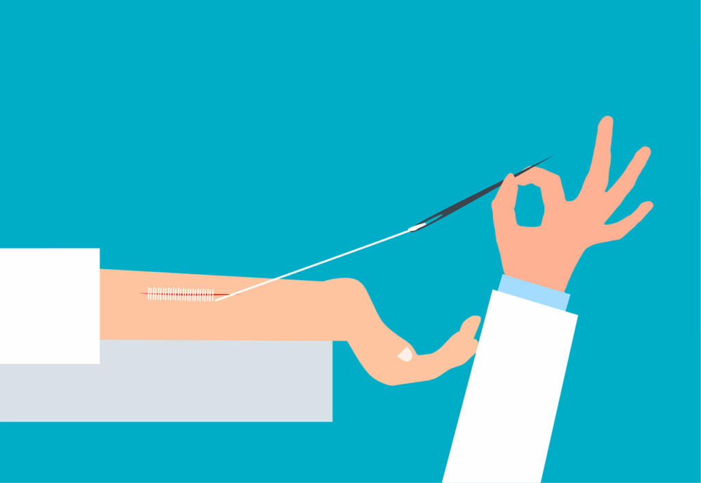 suture, surgery, wound, injury, scar, surgical stitch, doctor, healthcare, first aid, suture, suture, surgery, surgery, wound, wound, wound, wound, wound, injury, scar, scar, scar, scar