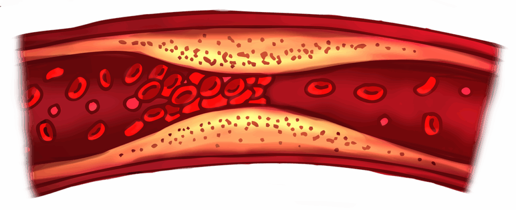 Beyond the Swell: Comprehensive Guide to Critical Blood Clot Warning Signs, Including Those Starting in Your Arm
